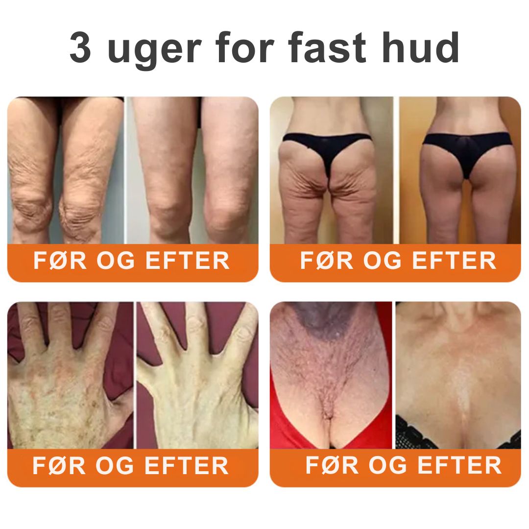 Lumora™ – Den naturlige løsning mod rynker, slap hud og tabt elasticitet