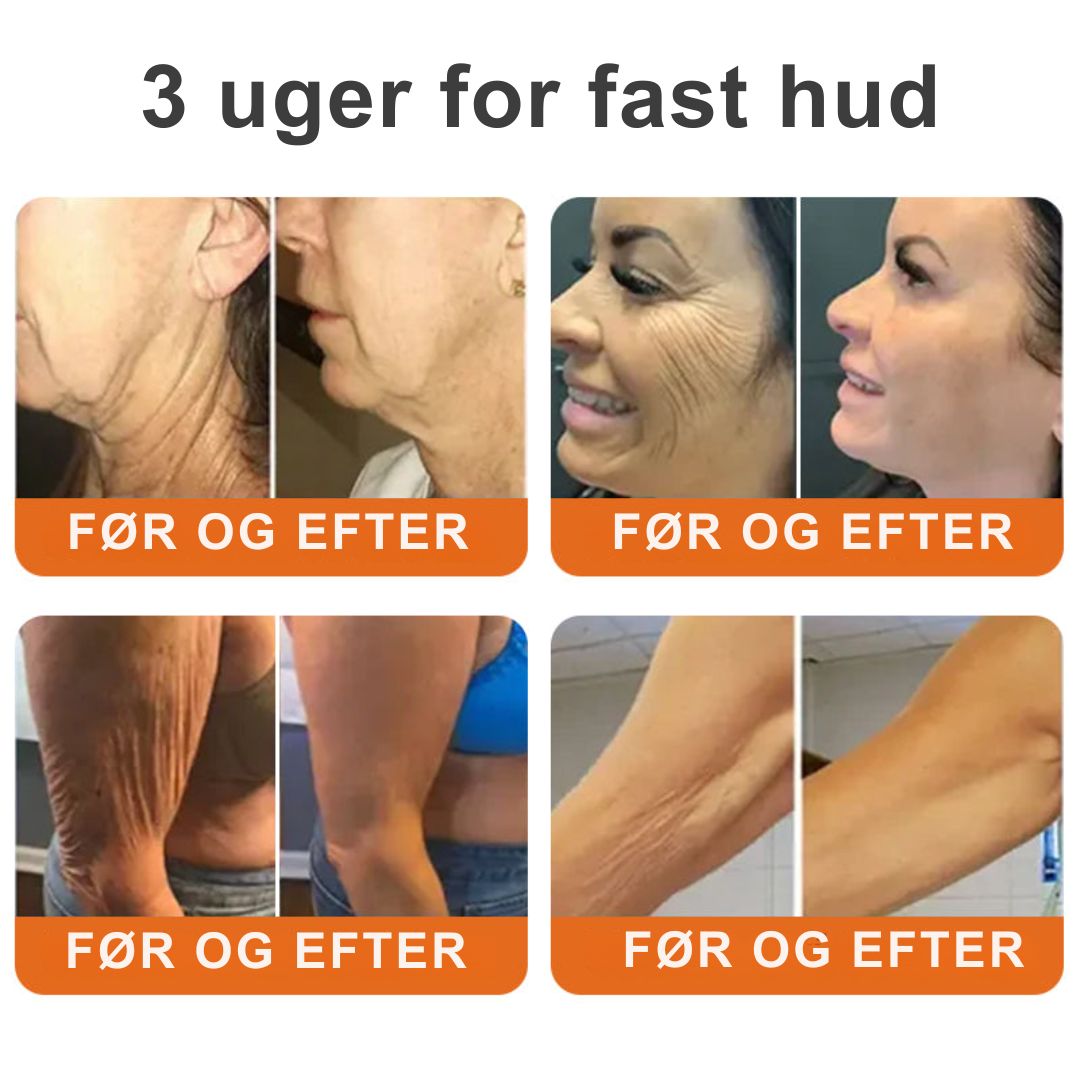 Lumora™ – Den naturlige løsning mod rynker, slap hud og tabt elasticitet