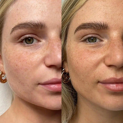 LumiSkin™ – Din naturlige glød, uden sol og uden besvær