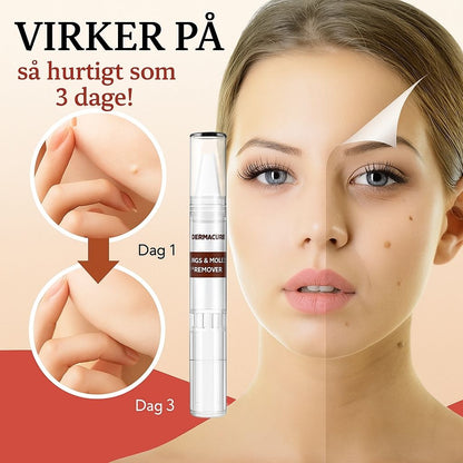 DermaGlow™ | Fjerner vorter og alderspletter – smertefrit inden for 3 dage!