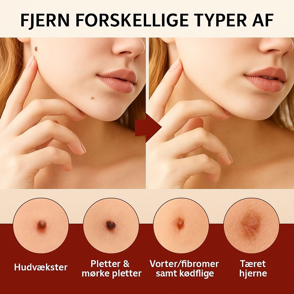DermaGlow™ | Fjerner vorter og alderspletter – smertefrit inden for 3 dage!