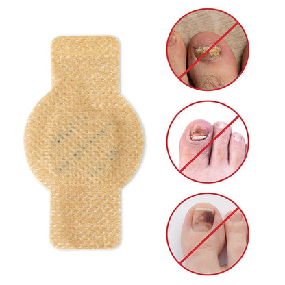 ClearNail™ - Antibakteriel Svampepatch Og Neglepleje Pakk