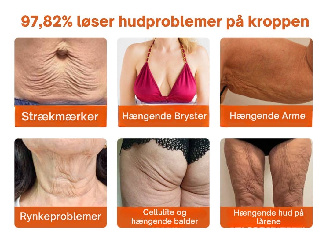 Lumora™ – Den naturlige løsning mod rynker, slap hud og tabt elasticitet