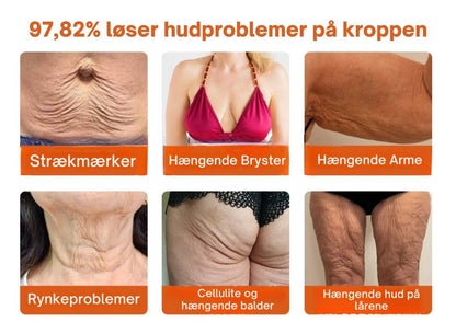 Lumora™ – Den naturlige løsning mod rynker, slap hud og tabt elasticitet