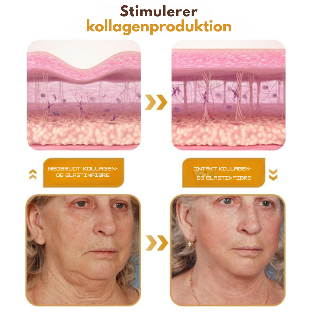 RynkeVæk™ | Botox Rynkefjernende Creme