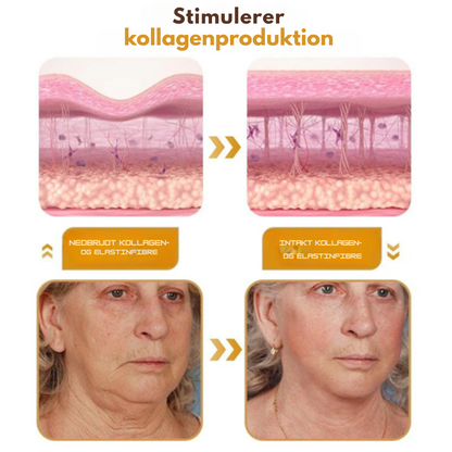 RynkeVæk™ | Botox Rynkefjernende Creme