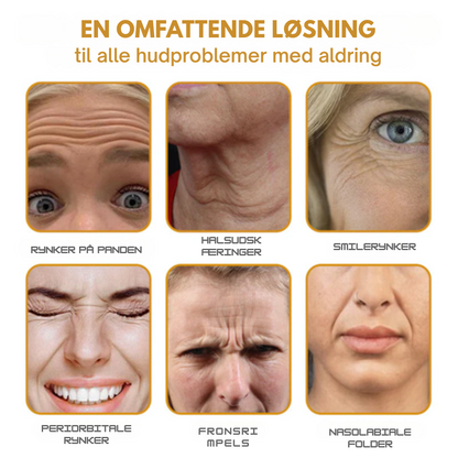 RynkeVæk™ | Botox Rynkefjernende Creme