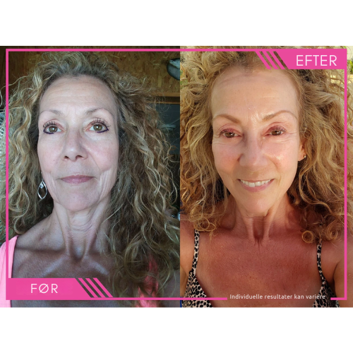 Lumivelle™ Super C Serum – Én flaske. Én rutine. Synligt yngre hud.