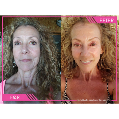 Lumivelle™ Super C Serum – Én flaske. Én rutine. Synligt yngre hud.