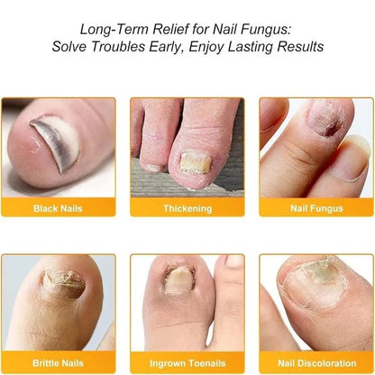 ClearNail™ - Antibakteriel Svampepatch Og Neglepleje Pakk