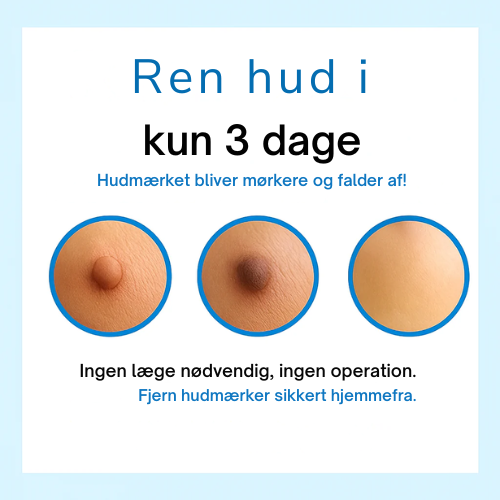 SkinPure™ Komplett Set - Nie wieder Hautanhängsel