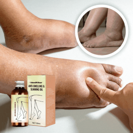 BenVital™ - Frihed til lette og friske ben på kun 7 dage