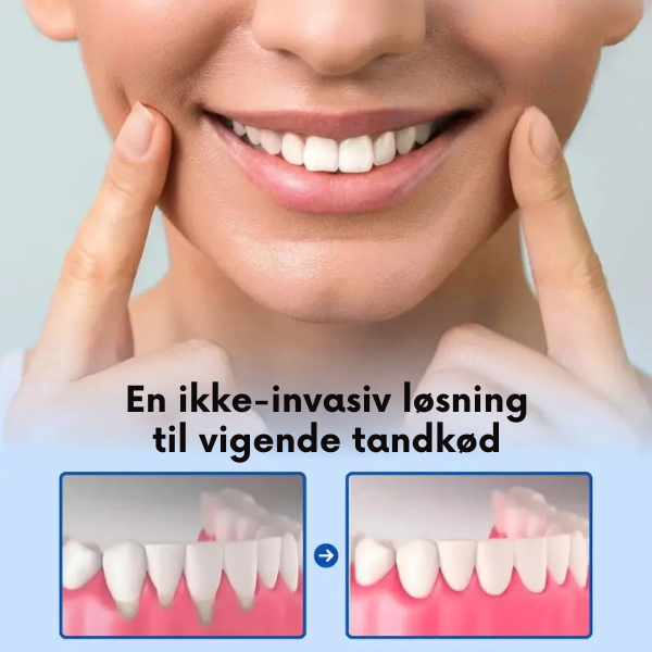 GumInstant™ - Ikke mere tilbagetrukket tandkød efter kun 3 dage!