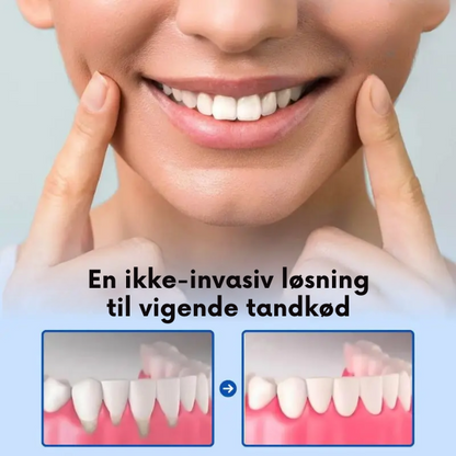 GumInstant™ - Ikke mere tilbagetrukket tandkød efter kun 3 dage!