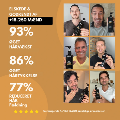East Moon™ Root Activator Shampoo – Få Tykere, Fyldigere Hår På Bare 10 Uger!