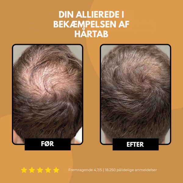 East Moon™ Root Activator Shampoo – Få Tykere, Fyldigere Hår På Bare 10 Uger!