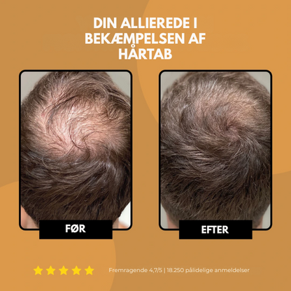 East Moon™ Root Activator Shampoo – Få Tykere, Fyldigere Hår På Bare 10 Uger!