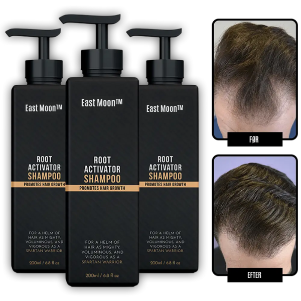 East Moon™ Root Activator Shampoo – Få Tykere, Fyldigere Hår På Bare 10 Uger!