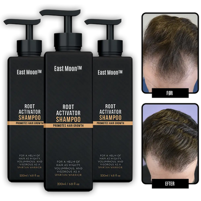 East Moon™ Root Activator Shampoo – Få Tykere, Fyldigere Hår På Bare 10 Uger!