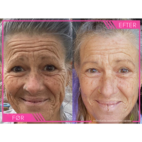 Lumivelle™ Super C Serum – Én flaske. Én rutine. Synligt yngre hud.