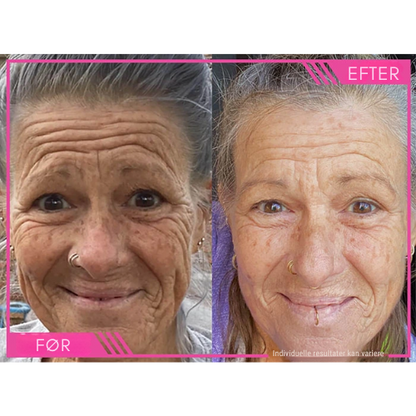 Lumivelle™ Super C Serum – Én flaske. Én rutine. Synligt yngre hud.