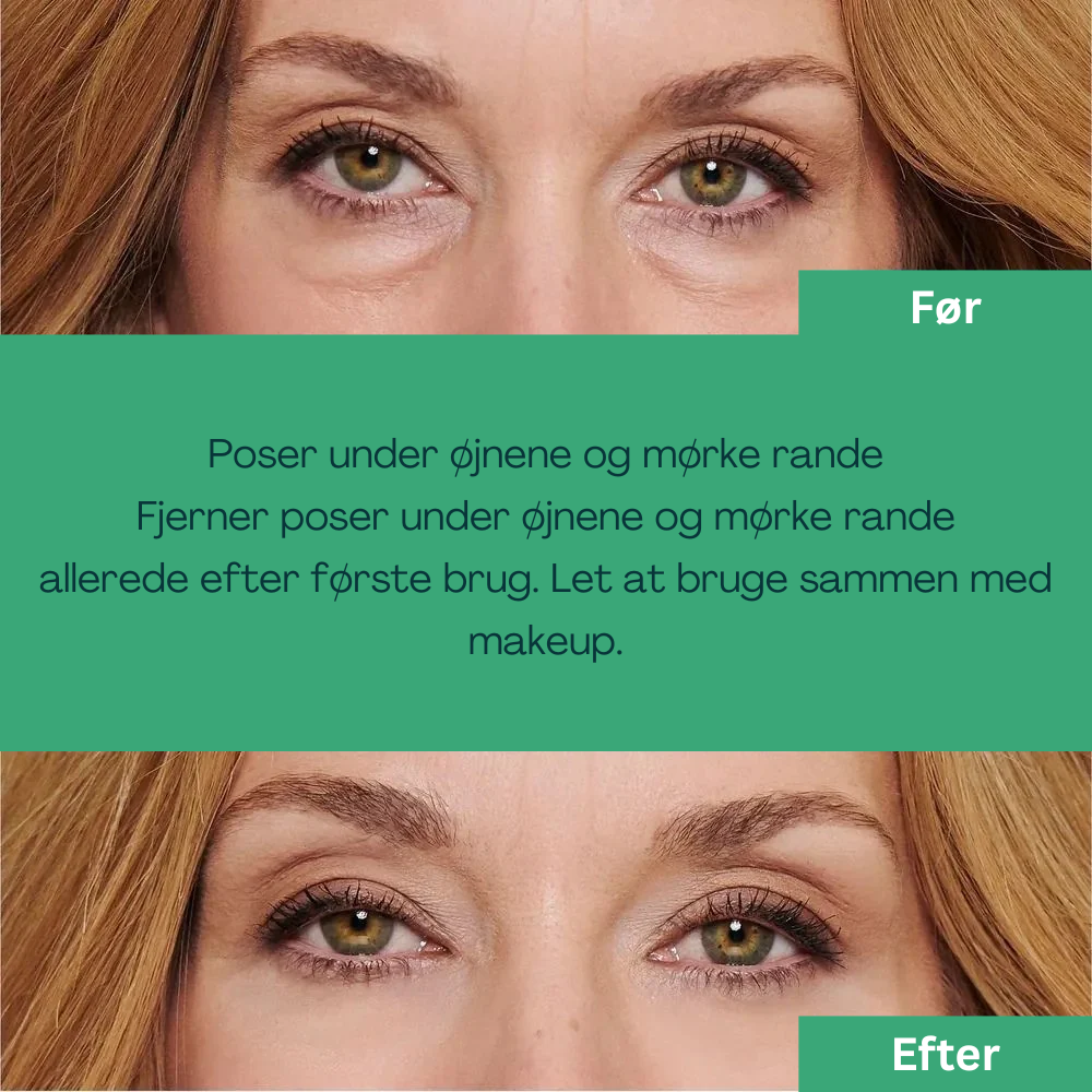 WestMonth Bright Up - Mine øjne ser allerede mere friske ud i dag ✨