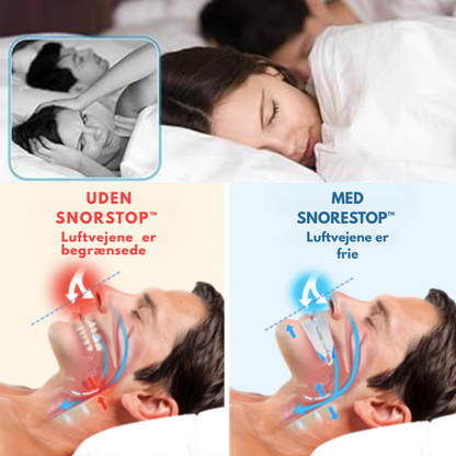 SnoreStop™ Anti-snorken mundstykke | Stop snorken – efter bare én nat!