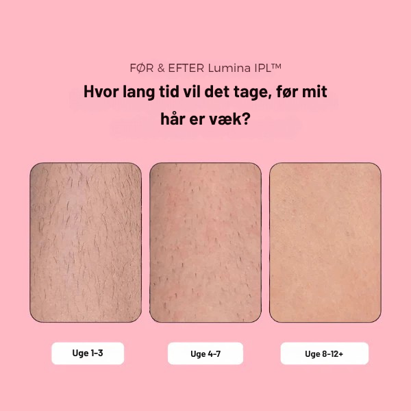 GlowLuxe™ IPL Laser – den smertefri løsning mod uønsket hårvækst og vejen til varig glat hud