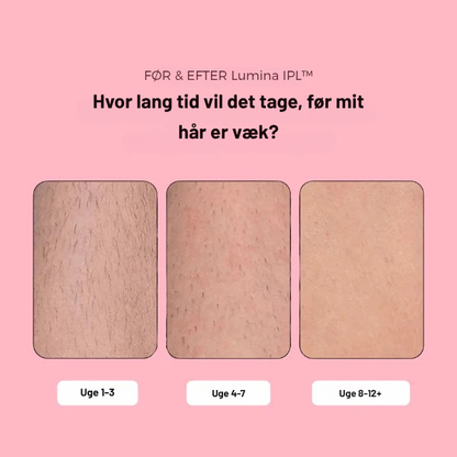 GlowLuxe™ IPL Laser – den smertefri løsning mod uønsket hårvækst og vejen til varig glat hud